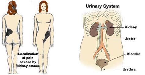 Where Your Kidneys are Located & Where Kidney Pain is Felt