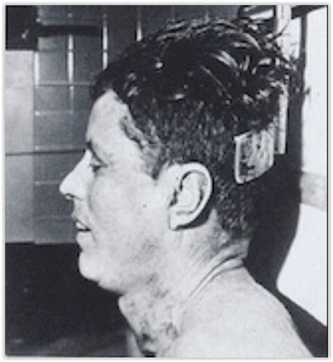 JFK: Bethesda Autopsy Photos not JFK, Oswald Framed, Warren Report a Sham – The Millennium Report