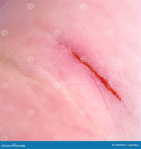 Cut on the skin stock image. Image of harm, macro, scar - 73054825