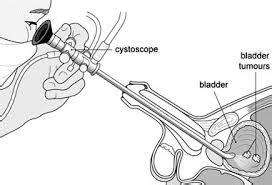 SURGSEMINAR: URINARY BLADDER 3 visualisation