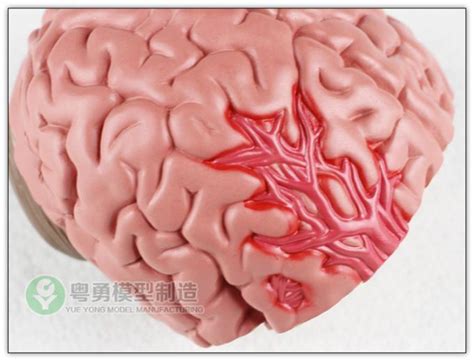 Pathologies Medical Brain Anatomy Model / Brain Human Anatomical Model