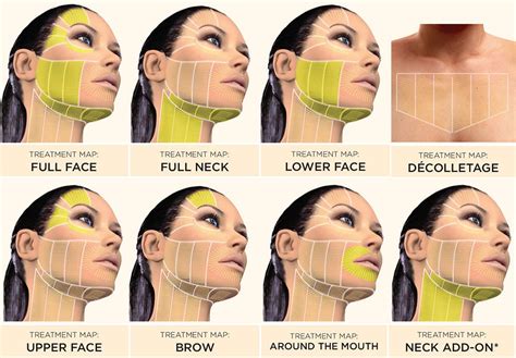 HIFU - Non Surgical Facelift