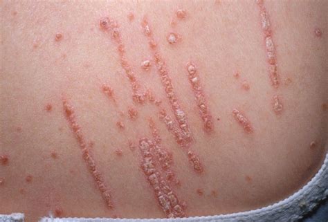 Pin on Dermatology