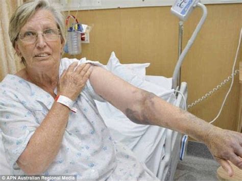 Edna-Mae Green saved by teen after being bitten by brown snake in ...