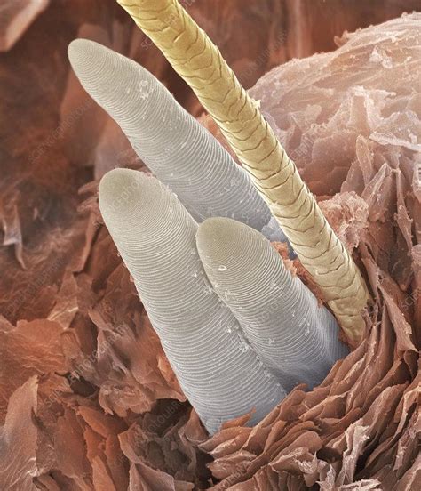 These are eyelash mites. These live in your eyelash pores. You have dozens of them living with ...
