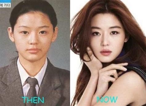 Bts Plastic Surgery Before And After | Before And After