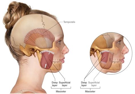 Masseter muscle - Origin, Insertion, Function, Exercise