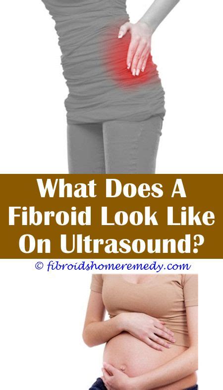 Can Fibroids Burst And Bleed | Uterine fibroids treatment, Fibroid cyst, Uterine fibroids