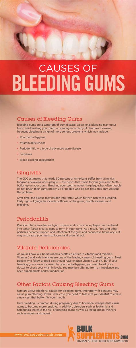 Tablo | Read 'Bleeding Gums: Characteristics, Causes & Treatment' by