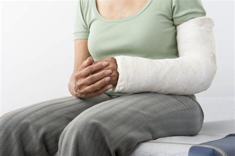 How Long Does Therapy for a Broken Elbow and Humerus Take? | Livestrong.com