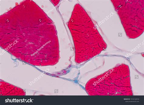 Education Anatomy Histological Sample Striated Muscle Stock Photo ...