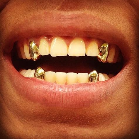 Can You Take Out Permanent Gold Teeth - Vanessa Fernandez Hochzeitstorte