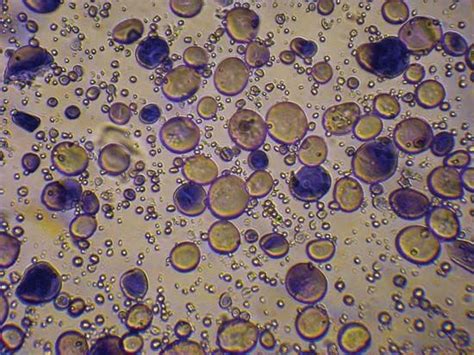 starch: wheat starch granules stained with iodine - Students | Britannica Kids | Homework Help