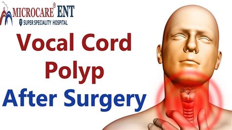 Vocal Cord Polyp After Surgery || MicroCare ENT Hospital - YouTube