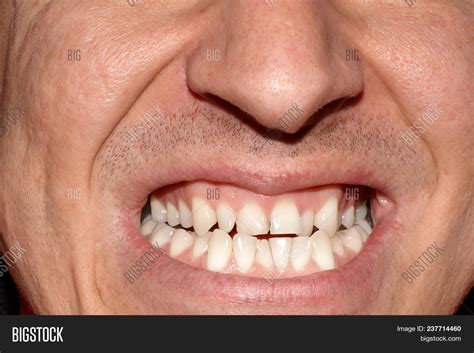 Ugly Teeth Smile