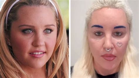 Amanda Bynes says having bleph surgery was 'one of the greatest things she ever did'