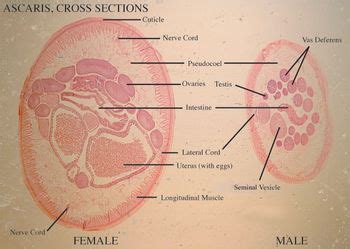 Answered: ASCARIS, CROSS SECTIONS Nerve Cord 1… | bartleby