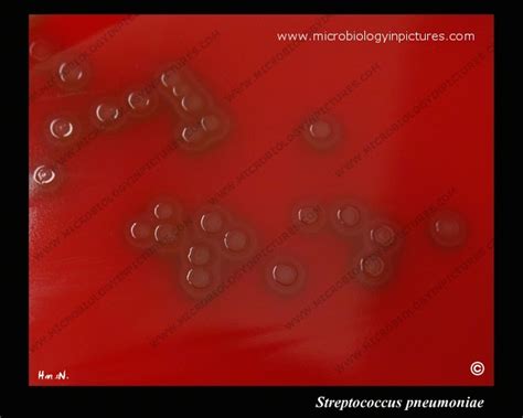 Alpha-hemolysis of Streptococcus pneumoniae on blood agar. Colonies characteristic of ...