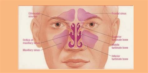 Maxillary sinus retention cysts symptomatic and causes