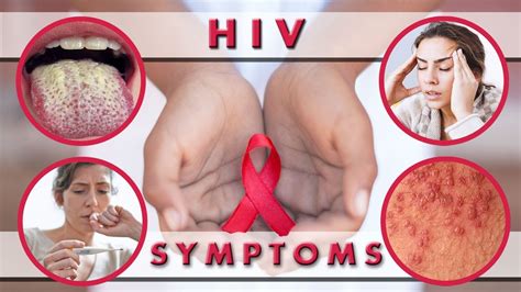 Aids Virus Symptoms Women