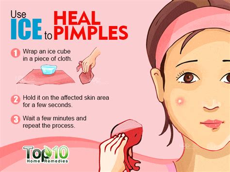 How to Get Rid of Pimples Fast | Top 10 Home Remedies | How to remove pimples, How to get rid of ...