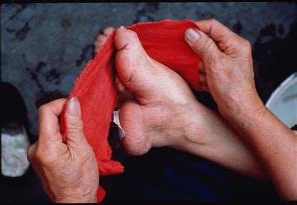 Foot Binding - Traditions of Altering Feet in China