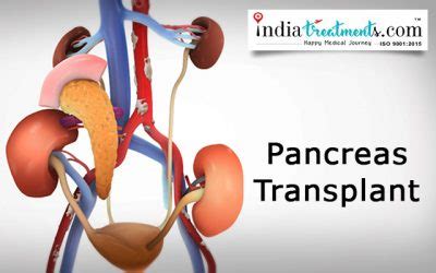 Pancreas Transplant