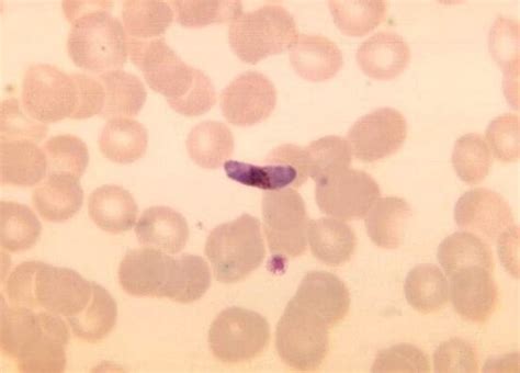 Free picture: plasmodium malariae, schizont, chromatin, masses, well, growing, trophozoites ...