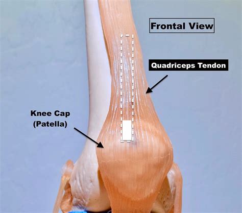 Essentials of Choosing an ACL Graft