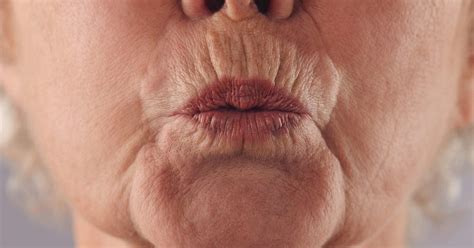 Pursed lip breathing: Benefits and how to do it