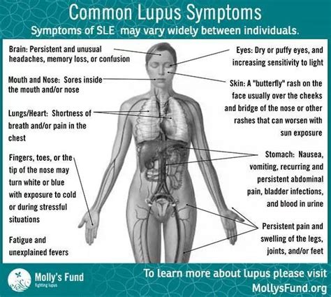 Lupus symptoms | Lupus symptoms, Lupus facts, Rheumatoid arthritis ...