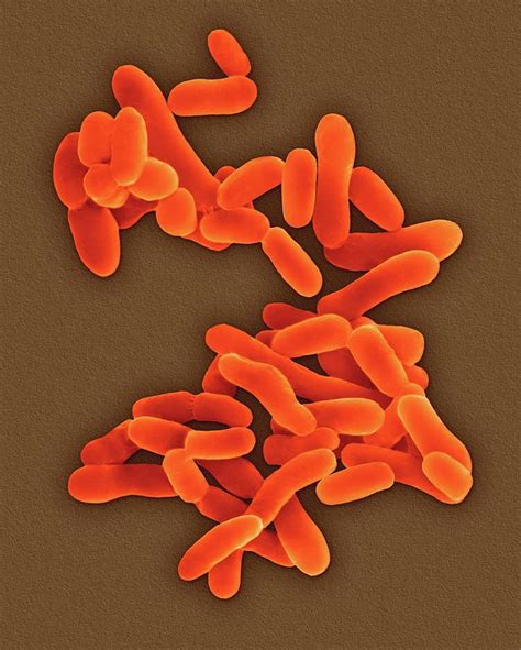 Mycobacterium Tuberculosis #9 Photograph by Dennis Kunkel Microscopy/science Photo Library ...