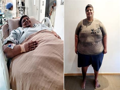 Bariatric Surgery Helps Man Weighing 262 Kgs Lose 41 Kg In One Month | TheHealthSite.com