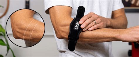 Perfect Tennis Elbow Brace Placement ~ 8-Steps + Pictures