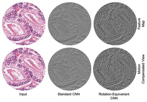 Colorectal Gland Segmentation: - AI牛丝