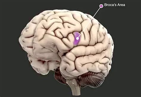 broca's aphasia location Archives - SAMARPAN PHYSIOTHERAPY CLINIC AHMEDABAD