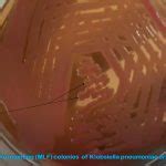 Preparation of MacConkey agar Archives - universe84a