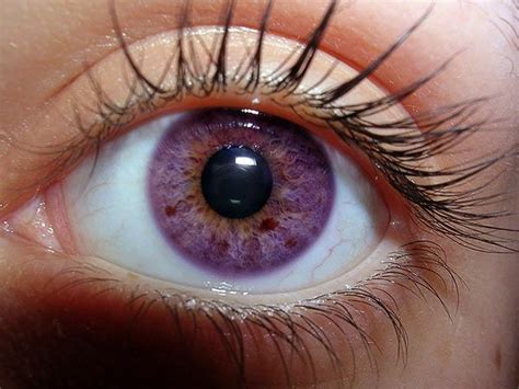 Purple Eyes Real Life