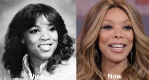 Wendy Williams Plastic Surgery Before and After Photos