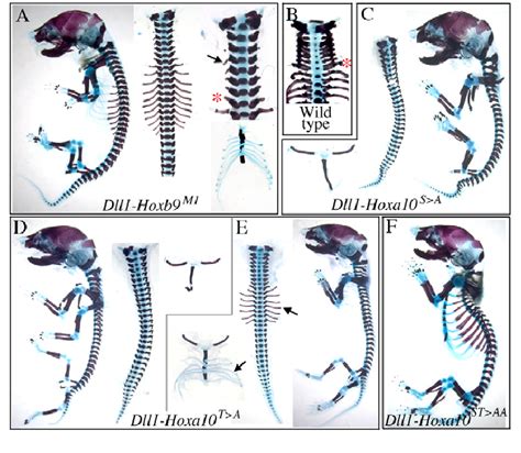 Skeletal phenotypes of transgenic mice expressing different mutant and... | Download Scientific ...