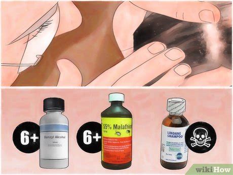 How to Treat Head Lice with Vinegar: 8 Steps (with Pictures)