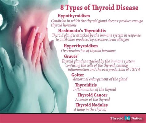 Pin by Alena Khimochka on Healthy Body | Hypothyroidism, Hypothyroidism ...