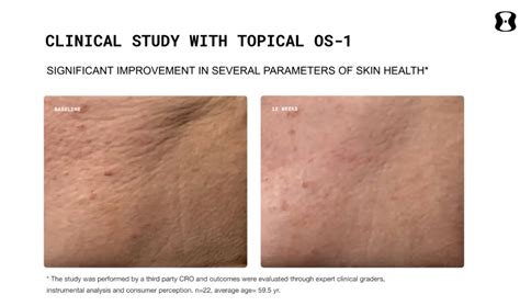 OneSkin Review - Before and After with Images — nickengerer.org