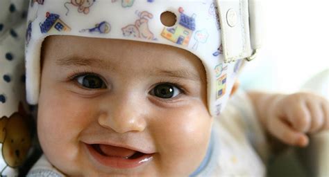 Plagiocephaly (flat head syndrome) | BabyCenter