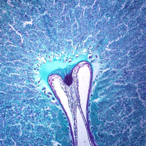 Wheat Grain (Triticum), cross section, Microscope Slide | Carolina.com