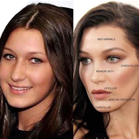 Love this transformation Bella Hadid! What do you think? Comment 👇 ...