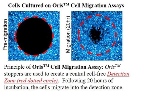 Cell-Migration-Assay | Platypus Technologies