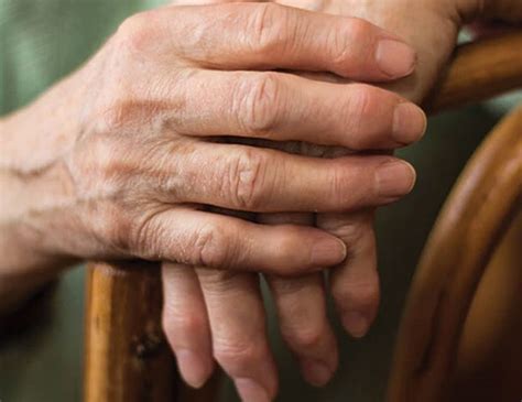 Is It Hand Arthritis?: How to Spot the First Signs & Ease Pain