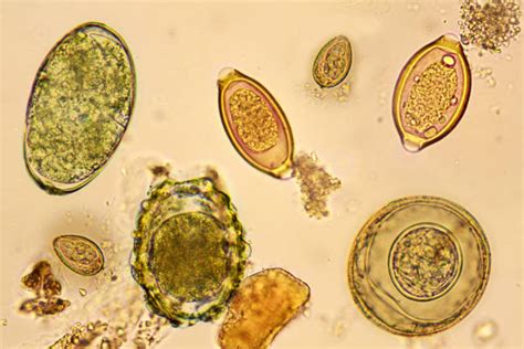 Tapeworm Egg Microscope