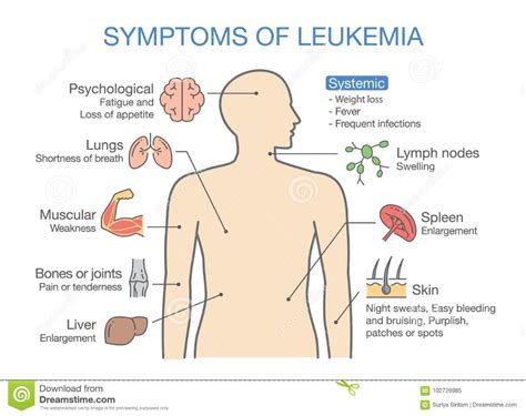 Common Symptoms And Signs Of Leukemia. Stock Vector - Illustration of bacteria, diagnose ...